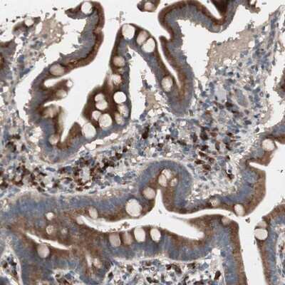 Immunohistochemistry-Paraffin: RARRES1 Antibody [NBP1-80684]