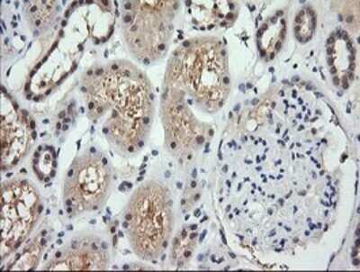 Immunohistochemistry: RARRES1 Antibody (OTI1D2) - Azide and BSA Free [NBP2-73803]