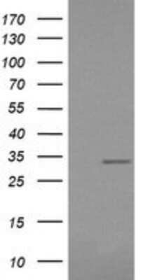 Western Blot: RARRES1 Antibody (OTI1D2)Azide and BSA Free [NBP2-73803]