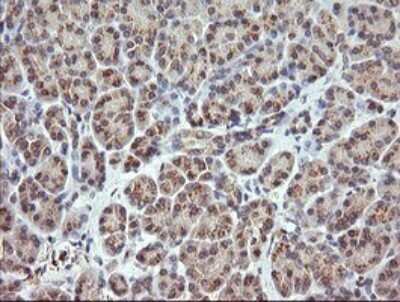 Immunohistochemistry: RARRES1 Antibody (OTI1D2) [NBP2-45517]