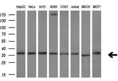 Western Blot: RARRES1 Antibody (OTI1D2) [NBP2-45517]