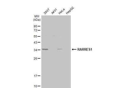 Western Blot: RARRES1 Antibody [NBP2-20079]