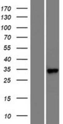 Western Blot: RARRES1 Overexpression Lysate [NBP2-04528]