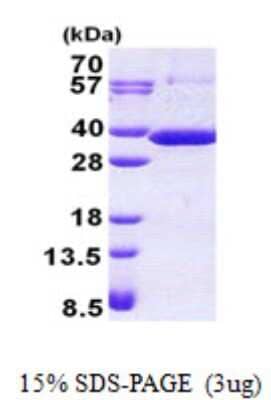 SDS-PAGE: Recombinant Human RARRES1 His Protein [NBP2-23411]