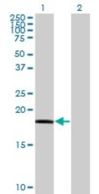 Western Blot: RARRES3 Antibody (1H5) [H00005920-M10]