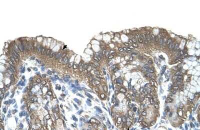 Immunohistochemistry-Paraffin: RARRES3 Antibody [NBP1-59395]