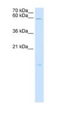 Western Blot: RARRES3 Antibody [NBP1-59395]