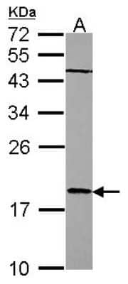 Western Blot: RARRES3 Antibody [NBP2-20080]