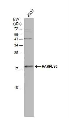 Western Blot: RARRES3 Antibody [NBP2-20080]