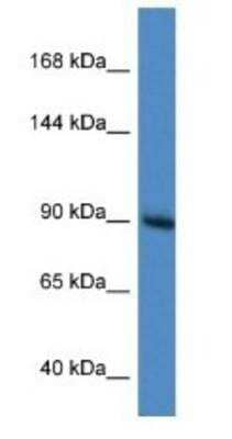 Western Blot: Ras-GAP Antibody [NBP1-74143]