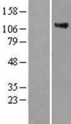 Western Blot: Ras-GAP Overexpression Lysate [NBL1-15164]