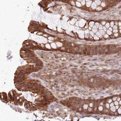 Immunohistochemistry-Paraffin: RASA3 Antibody [NBP1-92316]