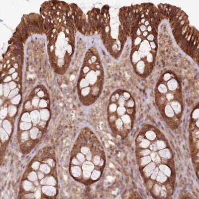 Immunohistochemistry-Paraffin: RASA3 Antibody [NBP1-92316]