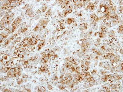 Immunohistochemistry-Paraffin: RASA3 Antibody [NBP2-20081]