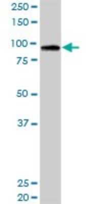 Western Blot: RASA3 Antibody [H00022821-D01P]