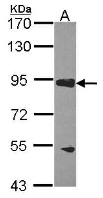 Western Blot: RASA3 Antibody [NBP1-31050]