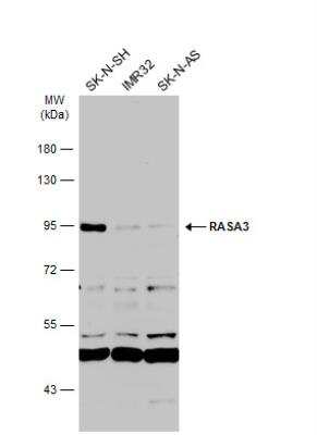 Western Blot: RASA3 Antibody [NBP2-20081]