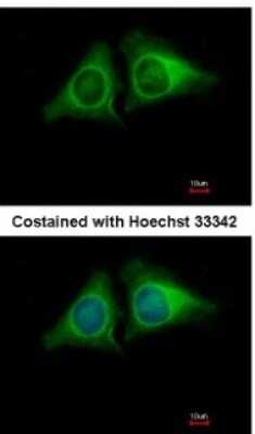 Immunocytochemistry/ Immunofluorescence: RASA4 Antibody [NBP2-15089]
