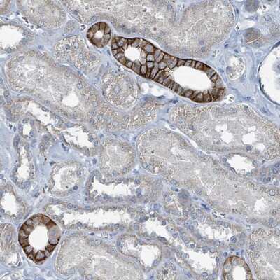 Immunohistochemistry-Paraffin: RASA4 Antibody [NBP2-13203]