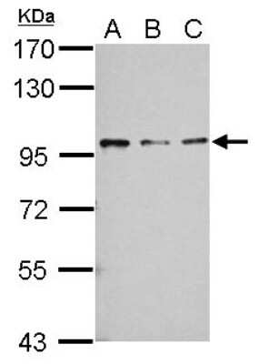 Western Blot: RASA4 Antibody [NBP2-15089]