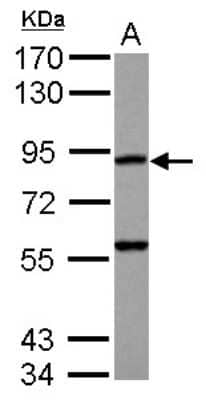 Western Blot: RASA4 Antibody [NBP2-15090]