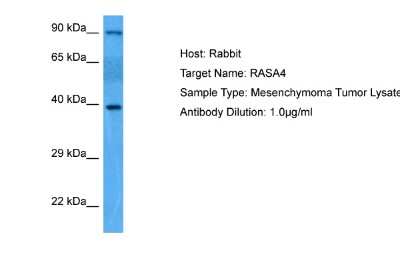 Western Blot: RASA4 Antibody [NBP2-88126]