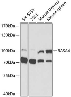 Western Blot: RASA4 AntibodyBSA Free [NBP2-93505]