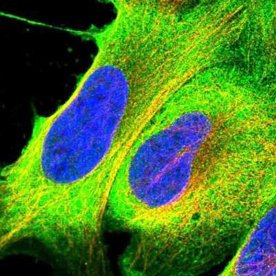 Immunocytochemistry/ Immunofluorescence: RASAL1 Antibody [NBP2-13204]