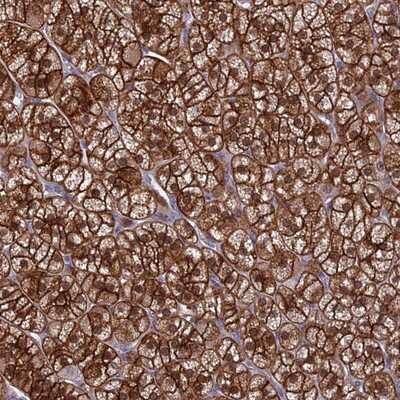 Immunohistochemistry-Paraffin: RASAL1 Antibody [NBP2-13204]