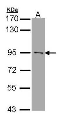 Western Blot: RASAL1 Antibody [NBP1-32776]