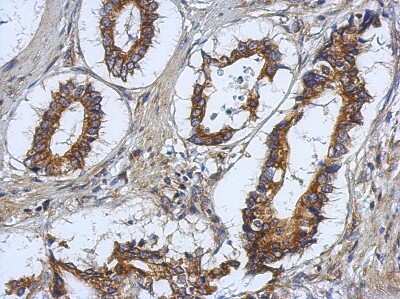 Immunohistochemistry-Paraffin: RASAL2 Antibody [NBP2-20082]