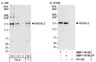 Western Blot: RASAL2 Antibody [NBP1-19150]