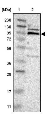 Western Blot: RASAL2 Antibody [NBP1-82578]