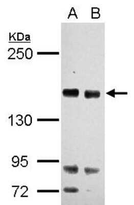 Western Blot: RASAL2 Antibody [NBP2-20082]