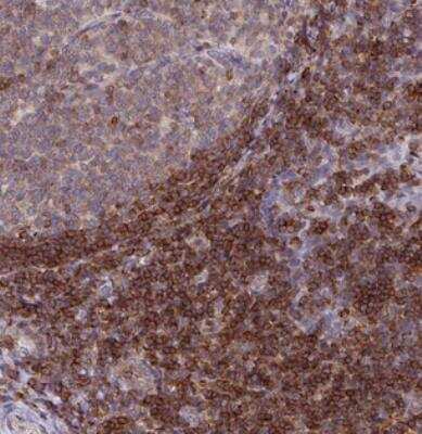 Immunohistochemistry-Paraffin: RASAL3 Antibody [NBP2-30891]