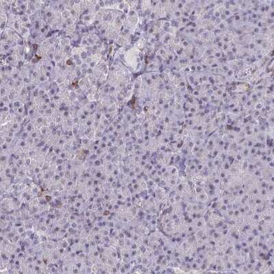 Immunohistochemistry-Paraffin: RASAL3 Antibody [NBP2-30891]