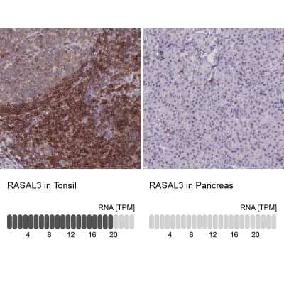 Immunohistochemistry-Paraffin: RASAL3 Antibody [NBP2-30891]