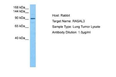 Western Blot: RASAL3 Antibody [NBP2-83438]