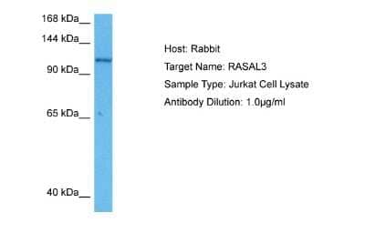 Western Blot: RASAL3 Antibody [NBP2-83439]