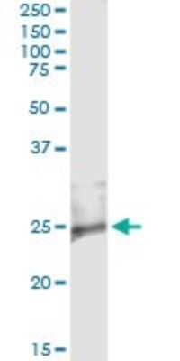 Immunoprecipitation: RASD2 Antibody (1C7) [H00023551-M02]