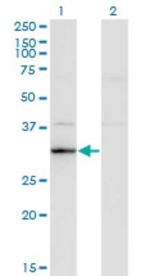 Western Blot: RASD2 Antibody (1C7) [H00023551-M02]