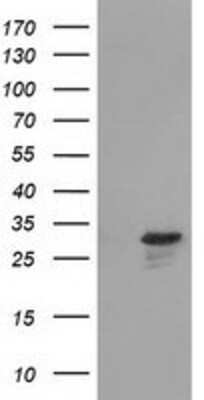 Western Blot: RASD2 Antibody (OTI1F7) [NBP2-03331]