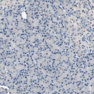 Immunohistochemistry-Paraffin: RASD2 Antibody [NBP1-82775]