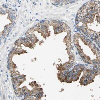 Immunohistochemistry-Paraffin: RASD2 Antibody [NBP1-82775]