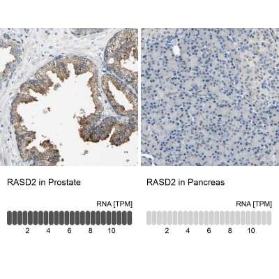 Immunohistochemistry-Paraffin: RASD2 Antibody [NBP1-82775]
