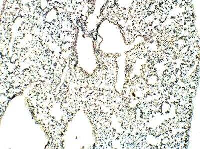 Immunohistochemistry-Paraffin: RASD2 Antibody [NBP3-12373]