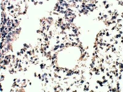 Immunohistochemistry-Paraffin: RASD2 Antibody [NBP3-12373]