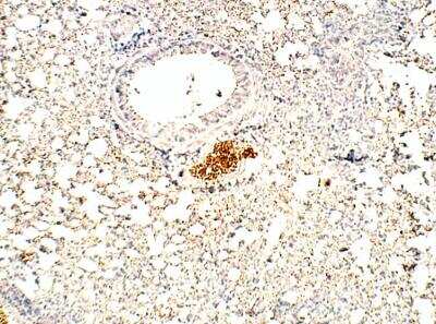 Immunohistochemistry-Paraffin: RASD2 Antibody [NBP3-12373]