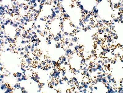 Immunohistochemistry-Paraffin: RASD2 Antibody [NBP3-12373]