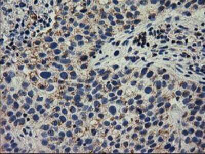 Immunohistochemistry: RASD2 Antibody (OTI1F7) - Azide and BSA Free [NBP2-73808]
